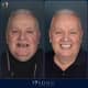 Slider image (9) Soho Dental Clinic – All-on-X & Dental Implant Center